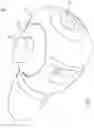 Fig. 02 - SUTURE RETENTION DEVICES