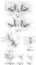 Fig. 02 - MAXILLA REPOSITIONING IMPLANT WITHOUT FINGER-TYPE STRUCTURES