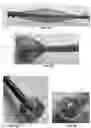 Fig. 02 - BRAIDED OR WOVEN ELECTRODES
