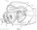 Fig. 05 - EXHAUST DIFFUSER ARRANGEMENT AND CPAP MASK INCLUDING SAME