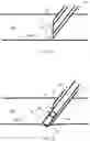 Fig. 04 - VASCULAR ACCESS KIT