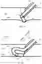 Fig. 05 - VASCULAR ACCESS KIT