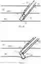 Fig. 07 - VASCULAR ACCESS KIT