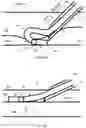Fig. 08 - VASCULAR ACCESS KIT