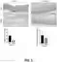 Fig. 02 - SYSTEMS AND METHODS FOR INCREASING INTESTINAL ABSORPTION OF THERAPEUTIC AGENTS