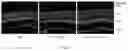 Fig. 04 - FUSION PROTEIN AND USE THEREOF