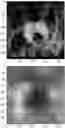 Fig. 01 - Radiogenomics for cancer subtype feature visualization