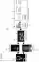 Fig. 02 - Large vessel occlusion detection and classification in medical imaging