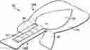 Fig. 01 - BODILY FLUID INDICATOR DEVICES AND METHODS