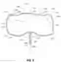 Fig. 03 - Systems and methods for treating aneurysms