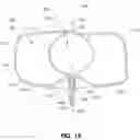 Fig. 11 - Systems and methods for treating aneurysms