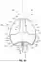 Fig. 19 - Systems and methods for treating aneurysms