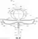 Fig. 23 - Systems and methods for treating aneurysms