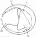 Fig. 01 - EXPANDABLE IMPLANTABLE CONDUIT