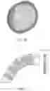 Fig. 04 - EXPANDABLE IMPLANTABLE CONDUIT
