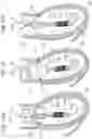 Fig. 22 - ASSEMBLY OF HEART VALVES AND INTERMEDIATE ADAPTER STENT