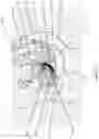 Fig. 04 - A DEVICE FOR INSERTION INTO A VAGINA