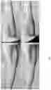Fig. 08 - PEPTIDE COMPOSITIONS AND METHODS FOR AMELIORATING SKIN LAXITY AND BODY CONTOUR