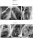 Fig. 09 - TOPICAL FORMULATIONS COMPRISING MONTELUKAST AND COMBINATIONS WITH MUSSEL ADHESIVE PROTEINS