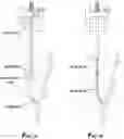 Fig. 02 - Active magnetic ranging while drilling