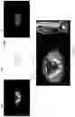Fig. 02 - SYSTEMS AND METHODS FOR ASSESSING DISEASE BURDEN AND PROGRESSION