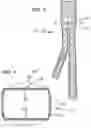 Fig. 03 - BIASED ENDOLUMINAL DEVICE