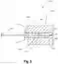 Fig. 06 - RELOCATION MODULE AND METHODS FOR SURGICAL EQUIPMENT