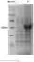 Fig. 02 - PHARMACEUTICAL COMPOSITION CONTAINING EXOSOME AND PREPARATION METHOD THEREOF