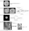 Fig. 03 - High-strength collagen sponge