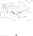 Fig. 02 - SLEEP APNEA TREATMENT SYSTEM AND METHOD