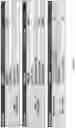 Fig. 32 - TIL expansion processes using specific cytokine combinations and/or AKTi treatment