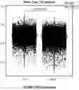 Fig. 409 - TIL expansion processes using specific cytokine combinations and/or AKTi treatment