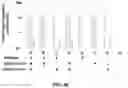 Fig. 49 - DIGITAL CRISPR-BASED METHOD FOR THE RAPID DETECTION AND ABSOLUTE QUANTIFICATION OF NUCLEIC ACIDS