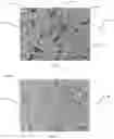 Fig. 02 - Method of eliminating microstructure inheritance of hypereutectic aluminum-silicon alloys