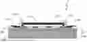 Fig. 01 - INTRACRANIAL PRESSURE SENSOR