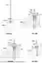 Fig. 35 - CONVERTIBLE SHOULDER ARTHROPLASTY SYSTEMS AND RELATED METHODS