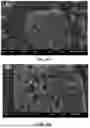 Fig. 09 - IMMOBILIZED CRUDE ENZYME FOR DEGRADING COMPLEX POLYCYCLIC AROMATIC HYDROCARBONs (PAHs) IN SOIL AND PREPARATION METHOD THEREOF