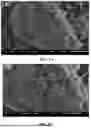 Fig. 10 - IMMOBILIZED CRUDE ENZYME FOR DEGRADING COMPLEX POLYCYCLIC AROMATIC HYDROCARBONs (PAHs) IN SOIL AND PREPARATION METHOD THEREOF