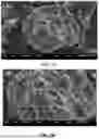 Fig. 12 - IMMOBILIZED CRUDE ENZYME FOR DEGRADING COMPLEX POLYCYCLIC AROMATIC HYDROCARBONs (PAHs) IN SOIL AND PREPARATION METHOD THEREOF