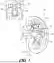 Fig. 02 - SYSTEMS AND METHODS FOR PLANNING MEDICAL PROCEDURES