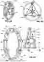 Fig. 09 - SYSTEMS AND METHODS FOR FOLDING AND PACKING A HUMAN POWERABLE VEHICLE