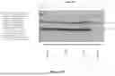 Fig. 11 - DNA CONSTRUCT FOR STABLY PRODUCING EMPTY CAPSIDS OF THE FOOT-AND-MOUTH DISEASE VIRUS IN MAMMALIAN CELLS; PROCESSES, USES, AND COMPOSITIONS THEREOF