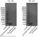 Fig. 20 - HYDROGELS CONTAINING AFFIBODIES AND USES THEREOF