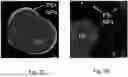 Fig. 08 - CHARGED SURFACTANT PARTICLES AND BRUSH POLYMERIC PARTICLES, METHODS OF MAKING SAME, AND USES THEREOF