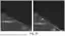 Fig. 53 - CHARGED SURFACTANT PARTICLES AND BRUSH POLYMERIC PARTICLES, METHODS OF MAKING SAME, AND USES THEREOF