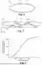 Fig. 05 - Electrically conductive adhesive
