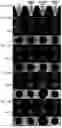Fig. 15 - METHOD FOR PRODUCING CARTILAGE CELLS INDUCED TO BE DIFFERENTIATED FROM STEM CELLS