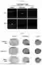 Fig. 21 - METHOD FOR PRODUCING CARTILAGE CELLS INDUCED TO BE DIFFERENTIATED FROM STEM CELLS