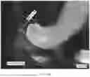 Fig. 12 - CONSUMABLE TISSUE-LIKE STRUCTURE GENERATED WITH MUSCLE CELLS GROWN ON EDIBLE HOLLOW FIBERS
