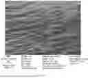 Fig. 20 - CONSUMABLE TISSUE-LIKE STRUCTURE GENERATED WITH MUSCLE CELLS GROWN ON EDIBLE HOLLOW FIBERS